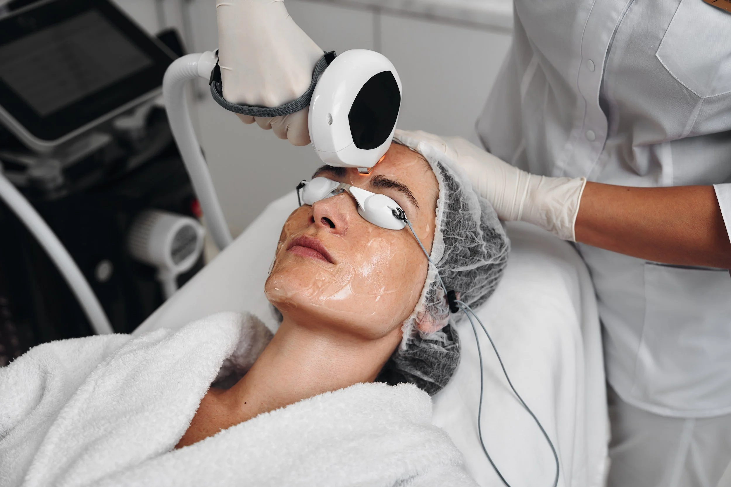 Laser Hair Removal - Full Body Package (6 Sessions) — ZZ Med Spa